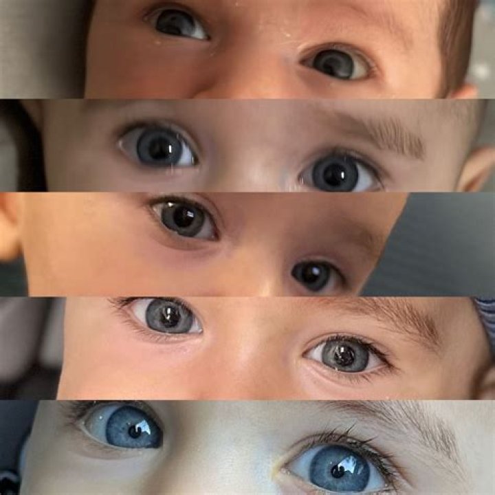 Are you born with full sized eyes?