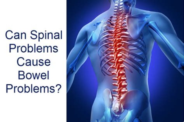 Can a pessary cause bowel problems?