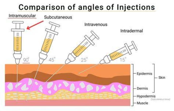 Do im injections need to be aspirated?
