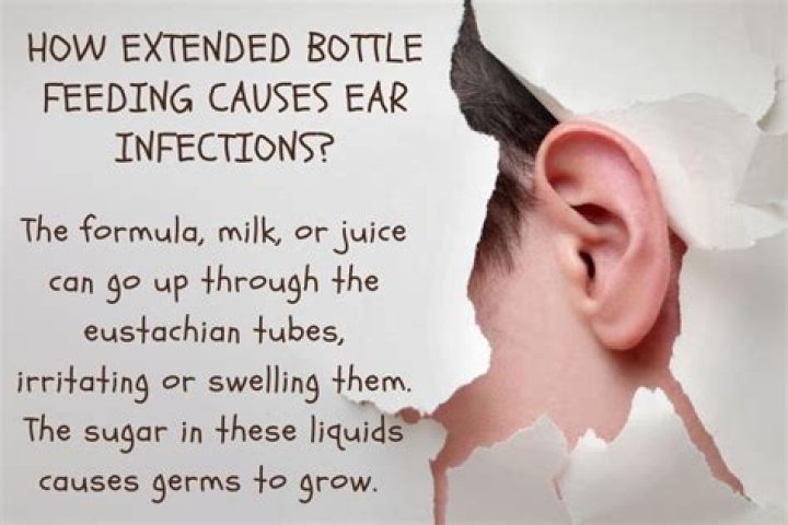 Does bottle feeding cause infections?