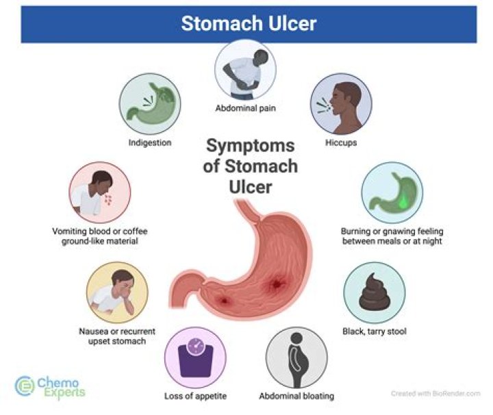 How do you get ulcers?