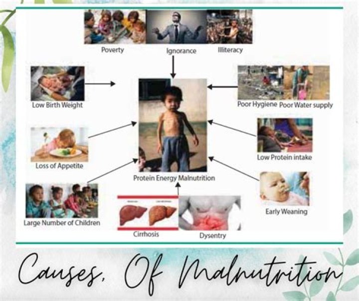 Is malnutrition a diseases?