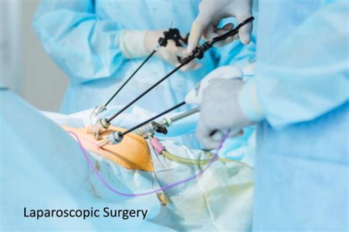 Is rectopexy major surgery?