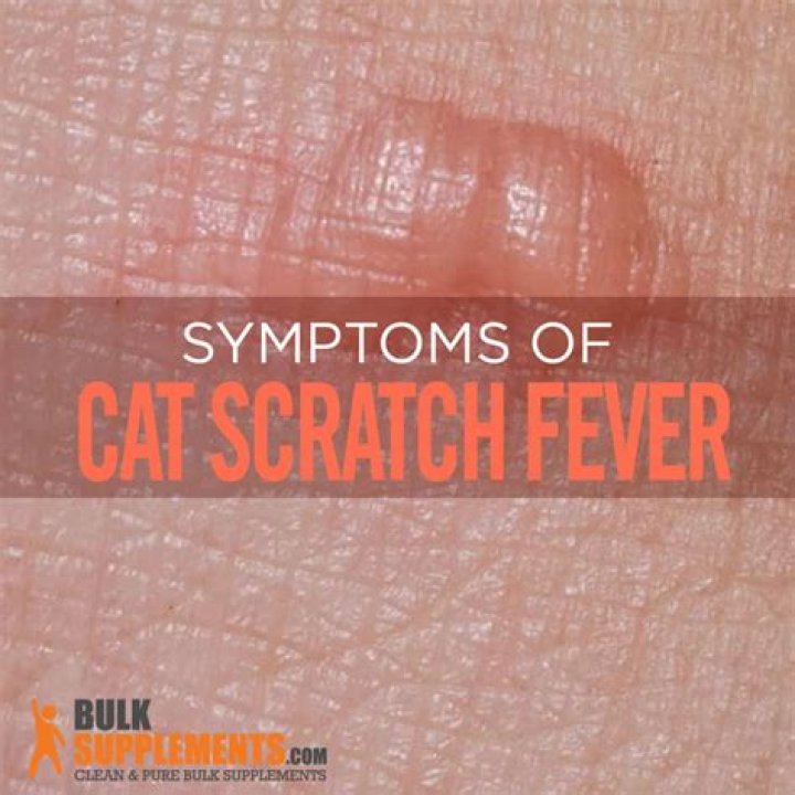 Was cat scratch fever?