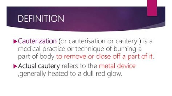 What is cauterizing the nose?