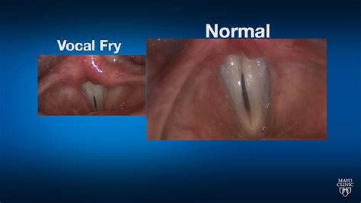 What is glottal fry?