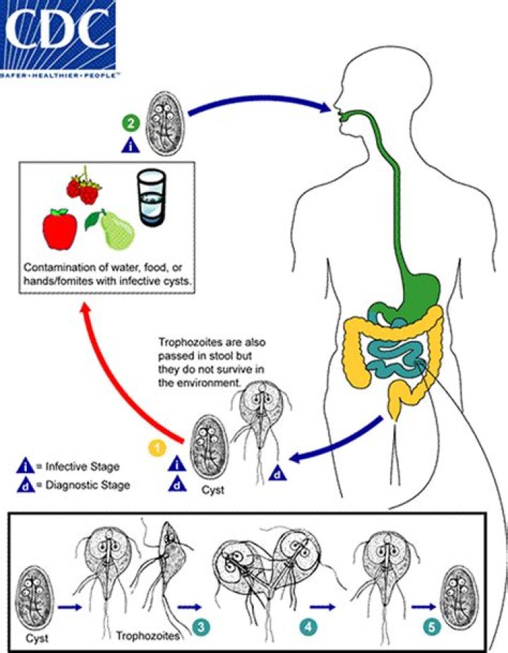 Where is giardiasis common?