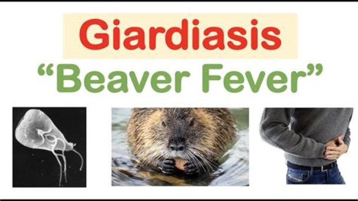 Why is it called beaver fever?