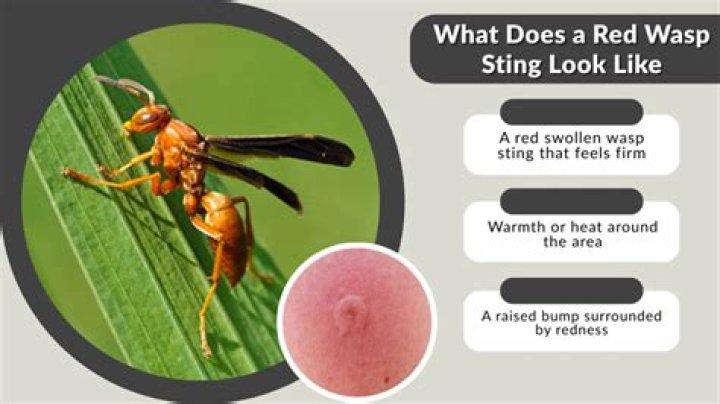 Why wasp stings hurt?
