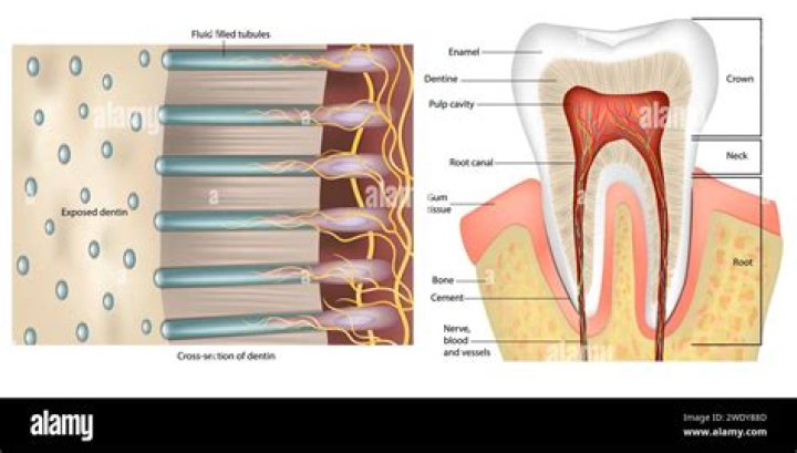 Will a sensitive tooth settle down?