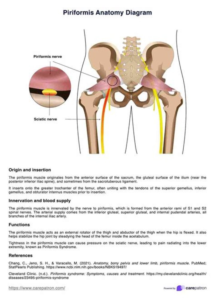 Will piriformis go away?